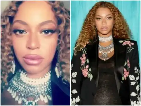 What happened to Beyonce's lips? (Photos)